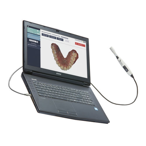 3D-Scanner für Zahnarztpraxis - CONDOR - Condor - intraoral