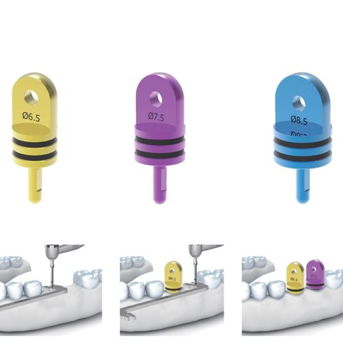 Dental-Parallelometer - Volume-Up Parallel Pin - Cowellmedi