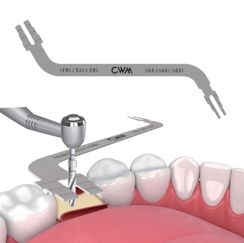 Parallele Tiefenlehre für Implantat - Volume-Up   - Cowellmedi