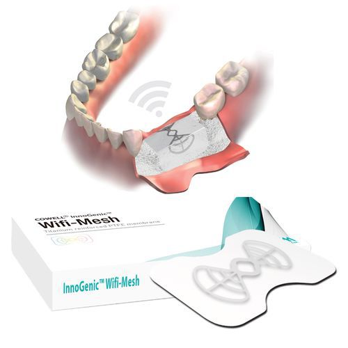 Zahnchirurgie-Matrix - InnoGenic™ Wifi-Mesh - Cowellmedi - PTFE