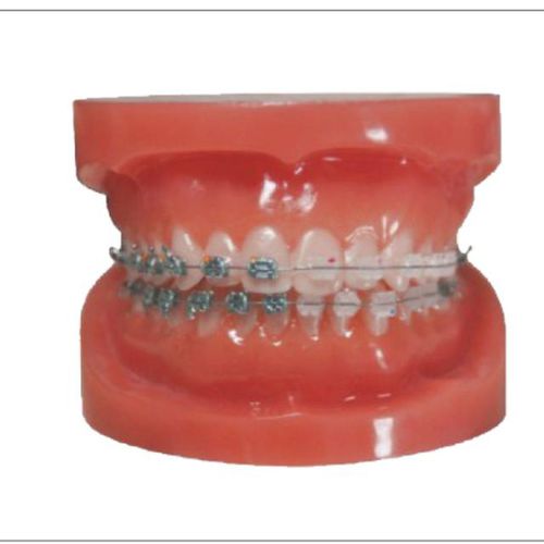 Gebiss-Typodont - Creative Dental - für Zahnbehandlung