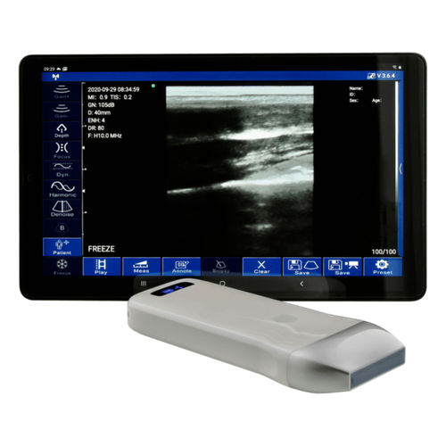 Ultraschall-Handgerät - WU9 series - Garda Laser - für Multifunktions-Ultraschall / Schwarz-Weiß / bildgebende Allzwecksonde