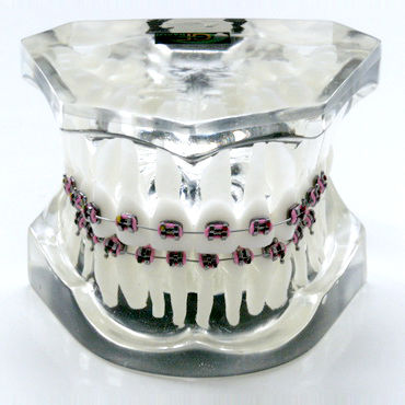 Anatomisches Modell / Gebiss - OTB1 - GF DENTAL - für Kieferorthopädie / Ausbildung / Harz