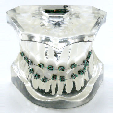 Anatomisches Modell / Gebiss - OTB2 - GF DENTAL - für Kieferorthopädie / Ausbildung / Harz
