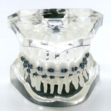 Anatomisches Modell / Gebiss - OTB3 - GF DENTAL - für Kieferorthopädie / Ausbildung / Harz