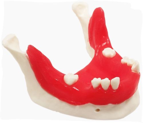 Anatomisches Modell / Unterkiefer - E21/T - GF DENTAL - für Implantologie / Ausbildung / rot
