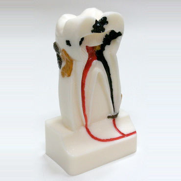Anatomisches Modell / Zahn - DM14 - GF DENTAL - Wurzelkanal / Dental / für Vorführzwecke