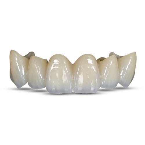 Zahnmedizinisches Material / Zirkonoxid - BruxZir® Esthetic - Glidewell Europe - zur Dentalrestaurierung
