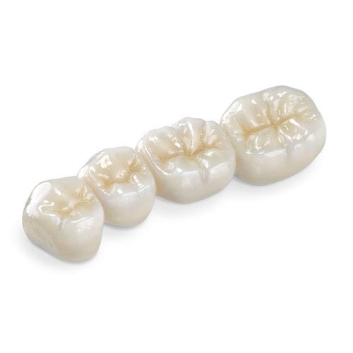 Zahnmedizinisches Material / Zirkonoxid - BruxZir® - Glidewell Europe - zur Dentalrestaurierung