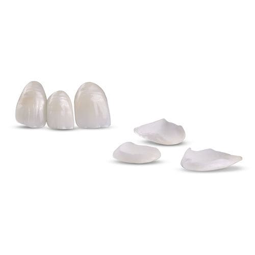 Zahnmedizinisches Material / Keramik - Veneers - Glidewell Europe - Zirkonoxid / Lithiumdisilikat / zur Dentalrestaurierung