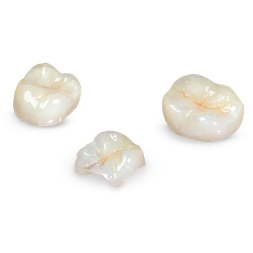 Zahnmedizinisches Material / Verbundwerkstoff - Glidewell Europe - für Zahnbrücken / für Dentalkronen / für Dentalinlays