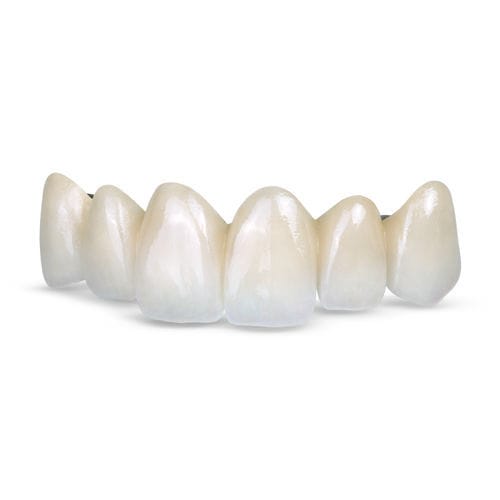Zahnmedizinisches Material / Keramik - Obsidian® Fused - Glidewell Europe - Lithiumdisilikat / für Zahnbrücken / für Dentalkronen