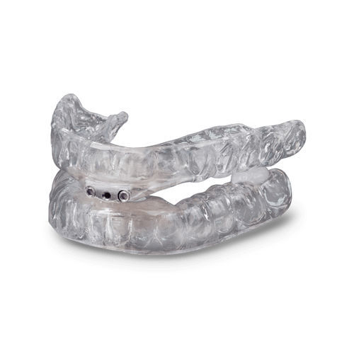 Anti-Schnarch-Gerät / Mundschiene - TAP® 3 TL - Glidewell Europe