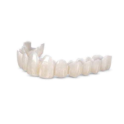 Harz-Zahnprothese - Smile Transitions™ - Glidewell Europe - für Vorderzähne / für Seitenzähne / abnehmbar