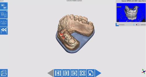 Erfassungssoftware - OPTORL - Open Tech 3D Srl - Beschaffung / CAD / Dental