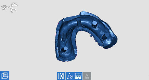 Erfassungssoftware - OPTORC - Open Tech 3D Srl - Beschaffung / Verordnung / Dental
