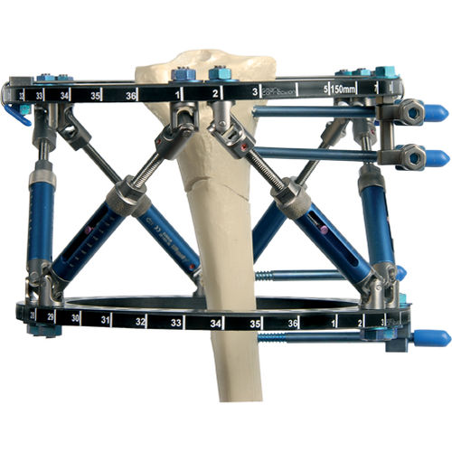 Modularer Fixateur externe - Smart Correction®  - Response Ortho - ringförmig / für Erwachsene