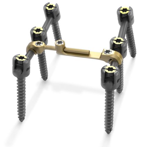 Thorako-lumbales Stabilisierungssystem für Osteosynthese - Quantum® - RTI Surgical - dorsaler Zugang / für Erwachsene