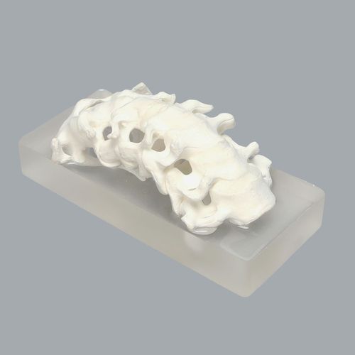 Anatomisches Modell / Wirbelsäule - 1326-53 - Sawbones/Pacific Research Labs - Halswirbelsäule / HWS / Zervikalmuskeln