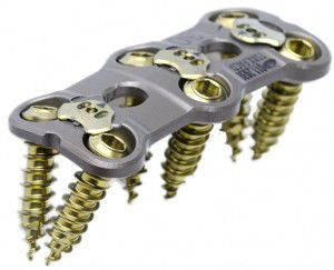 HWS-Arthrodeseplatte - VAN GOGH™ - CTL Medical Corporation - mit Verriegelung / Metall / 2 Ebenen