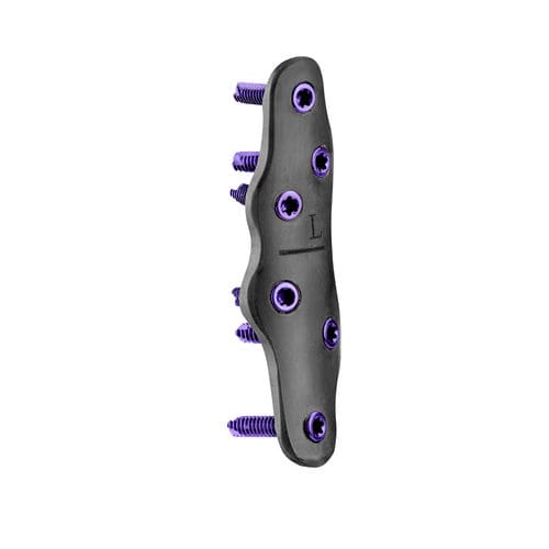 Arthrodeseplatte für Metatarsophalangealgelenk - CarboFix Orthopedics - mit Verriegelung / ohne Verriegelung / Metall