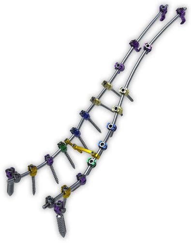 Stabilisierungssystem für Osteosynthese / Brust Lendenwirbelsäule und Kreuzbein - Lancer™ - ChoiceSpine - dorsaler Zugang / für Erwachsene
