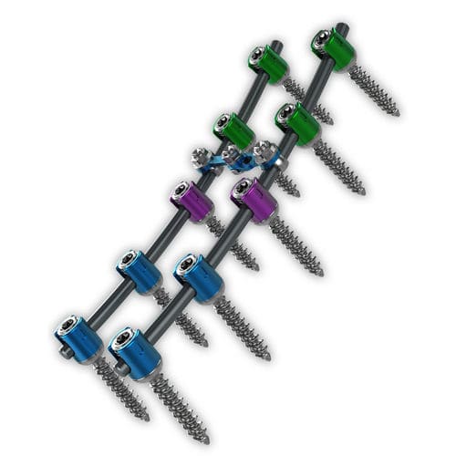 Thorako-lumbales Stabilisierungssystem für Osteosynthese - Proliant® - ChoiceSpine - dorsaler Zugang / für Erwachsene