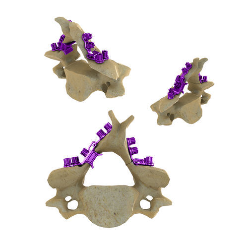 Laminoplastikplatte für Halswirbel - Blackbird™ HLS - ChoiceSpine - Metall