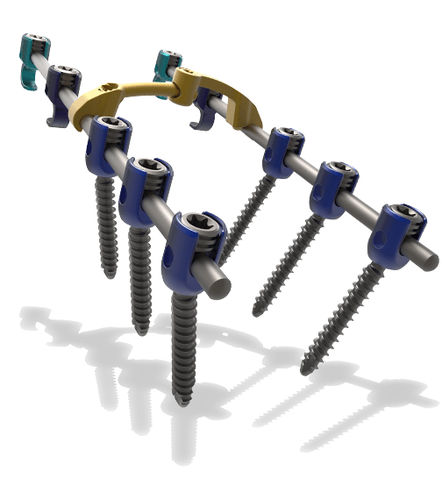 Zervikothorakales Stabilisierungssystem für Osteosynthese - Blackbird™ - ChoiceSpine - dorsaler Zugang / für Erwachsene