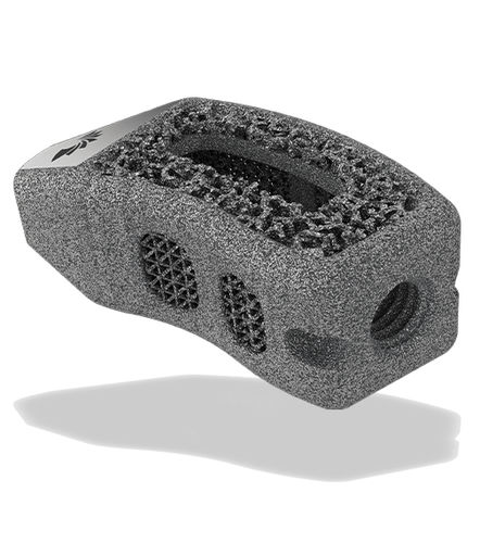 LWS-Zwischenwirbelimplantat - TigerShark® Threaded TL  - ChoiceSpine - transforaminaler Zugang / Titan / 3D-Druck