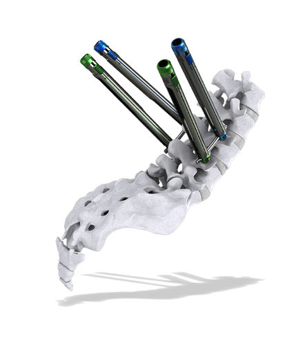 Minimalinvasives Pedikelschrauben-Positionierungssystem - Thunderbolt™ - ChoiceSpine
