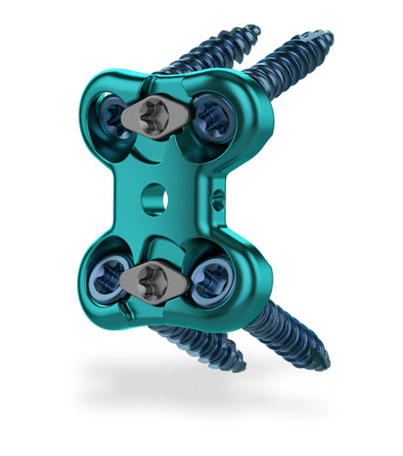 LWS-Arthrodeseplatte - Raven®  - ChoiceSpine - 1 Ebene