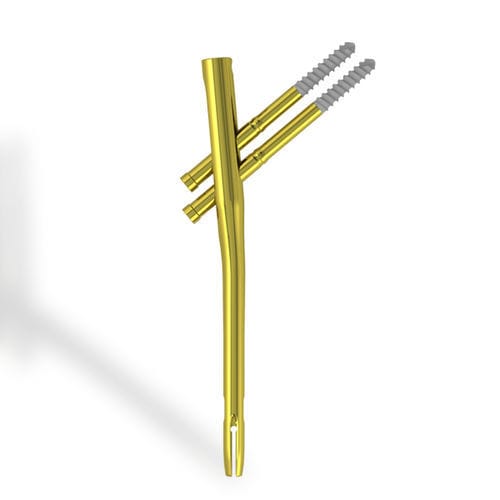 Marknagel für Oberschenkelknochen - EBA2 - Citieffe - mit diaphysärer Fixierung / mit proximaler Fixierung / Titan