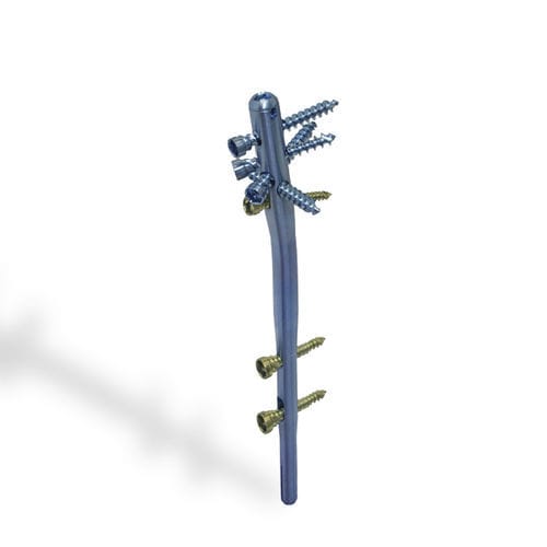 Marknagel / Humerus - DINAMIC T - Citieffe - mit proximaler Fixierung