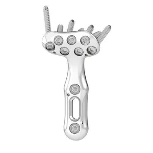 Kompressionsplatte für Radius - MTF - Intrauma - für Fibula / distal / mit Verriegelung