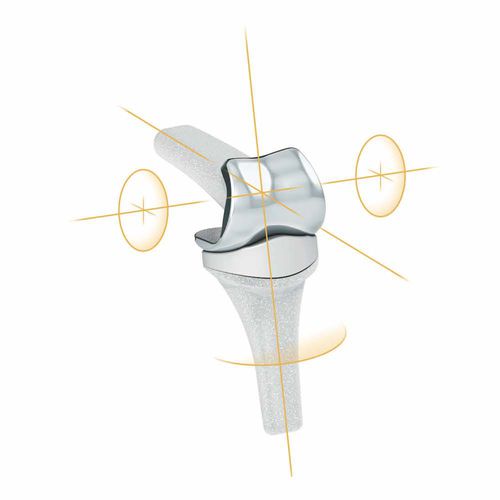 Implantat für Interphalangealgelenk der Hand - PIPR™ - MatOrtho
