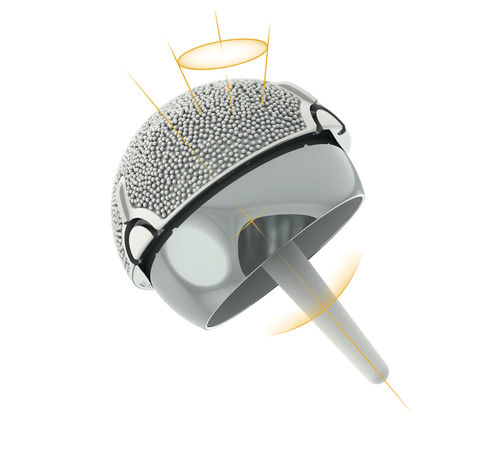 Hüftkopfprothese - ADEPT® - MatOrtho