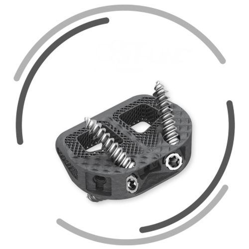 LWS-Zwischenwirbelimplantat - BIG ST - Signus Medical - ventraler Zugang / Titan