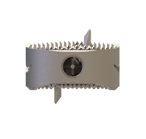 HWS-Zwischenwirbelimplantat - Capraia-Z ACIF - Tsunami Medical - ventraler Zugang / Titan