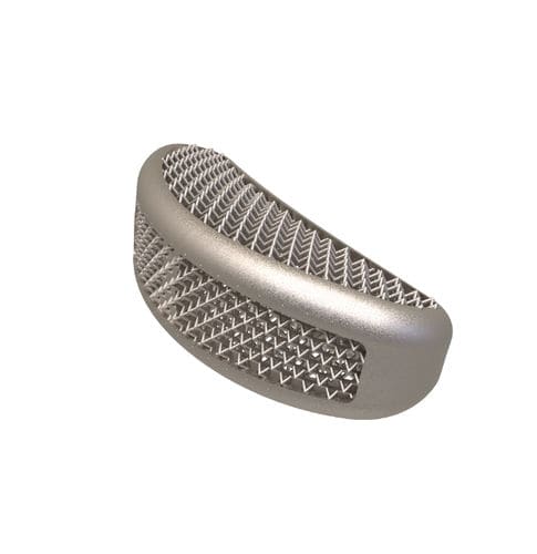 LWS-Zwischenwirbelimplantat - Elba TLIF - Tsunami Medical - transforaminaler Zugang / Titan