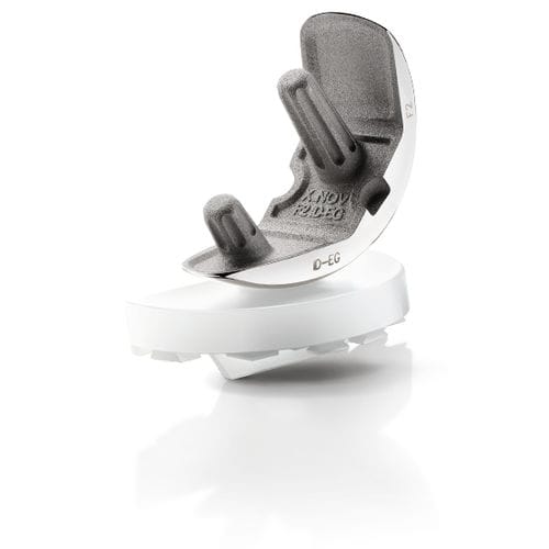 Einteilige Knieprothese - KAPS®Full PE - X-NOV Medical Technology - mit fester Scheibe