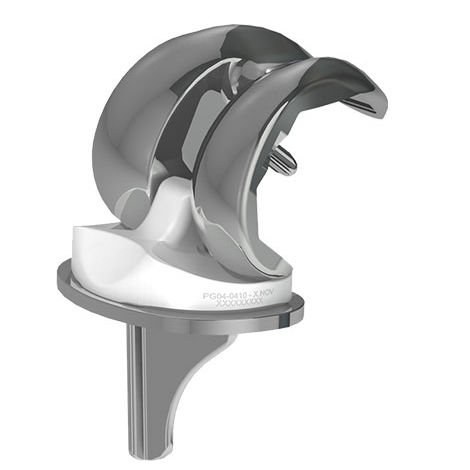 Femur-Patella Knieprothese - TRIUM® - X-NOV Medical Technology - mit mobiler Scheibe