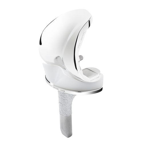 Femur-Patella Knieprothese - T.KAPS® - X-NOV Medical Technology - mit mobiler Scheibe