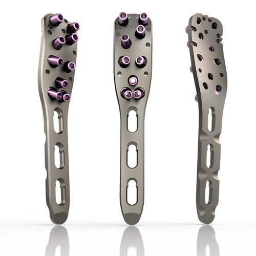 Kompressionsplatte für Humerus - 27 series - South America Implants - proximal / mit Verriegelung / Metall