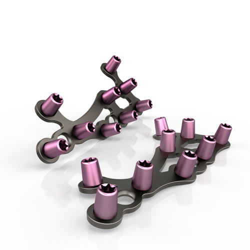 Kompressionsplatte für Vorfuß - 297 series - South America Implants - mit Verriegelung / Metall