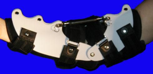 Ellbogenschiene - Turnbuckle - Tiburon Medical Enterprises - L / M / S