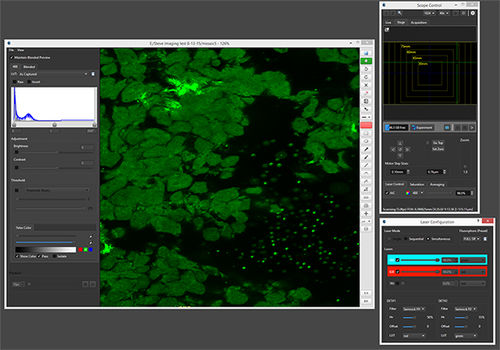 Medizinische Software - Caliber Imaging & Diagnostics - Analyse / Steuerung / Beschaffung