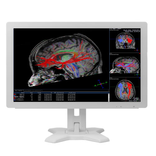 Monitor für medizinische Bildgebung - MMS-21CAHST  - BriteMED Technology - für medizinische Simulation / Full HD / 21,5"