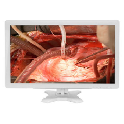 OP-Monitor - MMS-27CA serieqs - BriteMED Technology - 1920 x 1080 / 27" / hohe Helligkeit