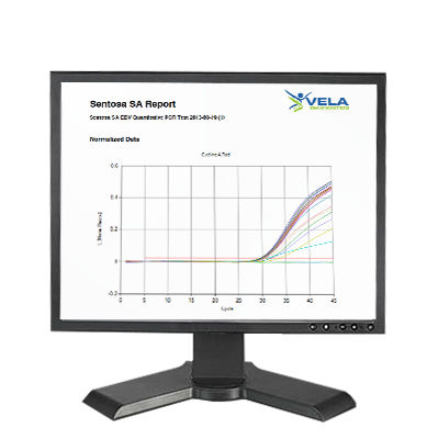Analysesoftware - Sentosa SA - Vela Diagnostics - Interpretation / Molekularbiologie
